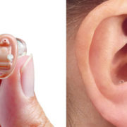 Hearing Aid Supplier in Chennai