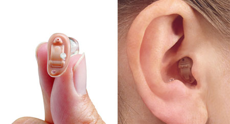 Hearing Aid Supplier in Chennai